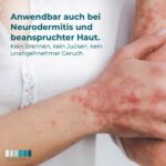 Desinfektion geeignet bei Neurodermitis